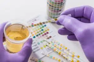 Urine Testing With A Drug Kit