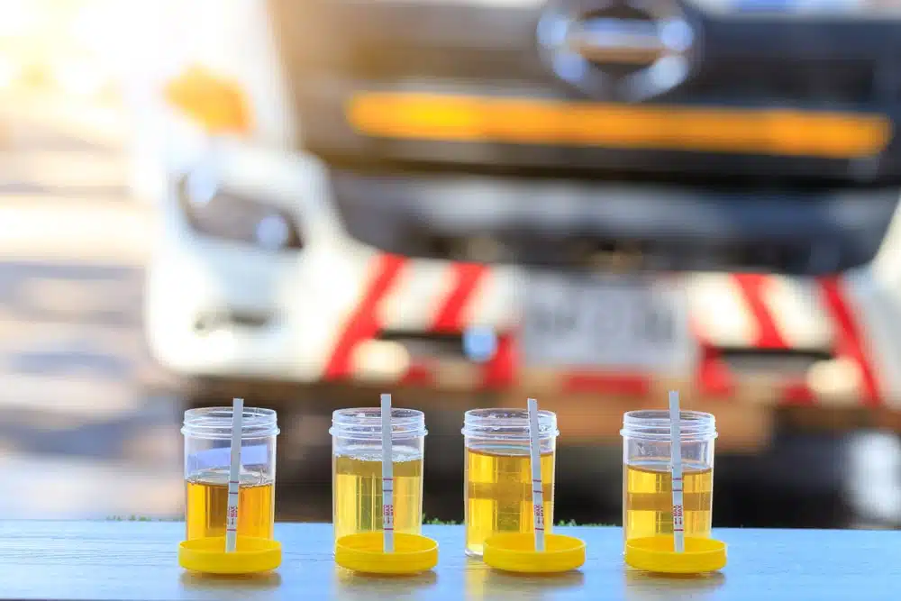 Urine Samples For Testing On A Table Next To A Truck